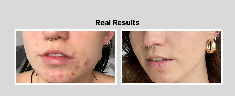 Cosrx Blackhead Removal Snail Essence BHA Salicylic Acid Cleaning Pores Removal Blackhead Horns Moisturizing 100ML Jay Cosmetic